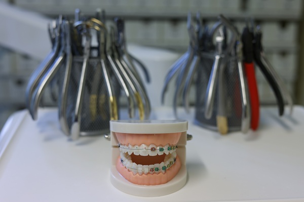 Braces Near Me: Tips To Help Prepare For Treatment