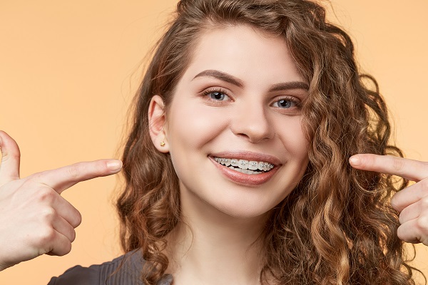 What To Consider With Ceramic Braces For Teeth Straightening