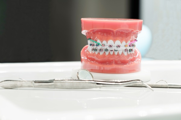 What Are Corrective Braces?